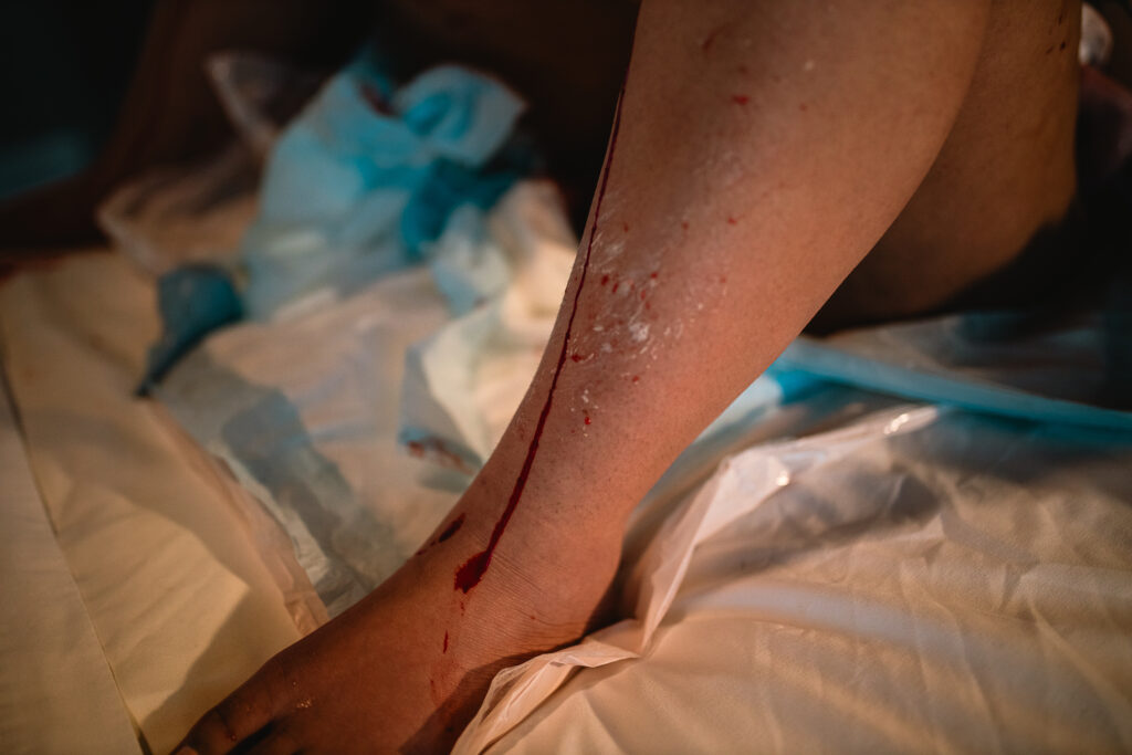 Close-up of the mother’s legs after birth, honoring the raw and physical reality of childbirth