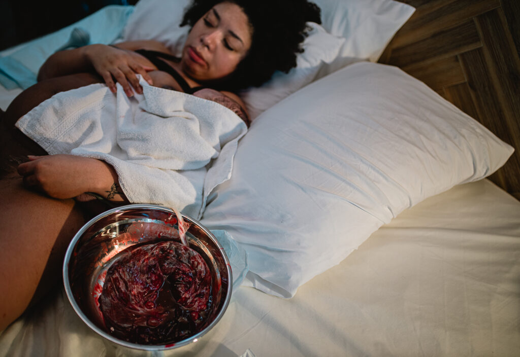 Midwife placing the placenta in a metal bowl during the immediate postpartum period