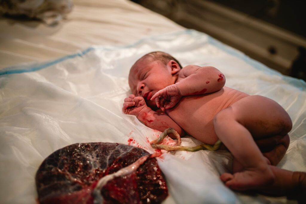 Newborn baby lying on a white pad beside the placenta, still attached by the umbilical cord