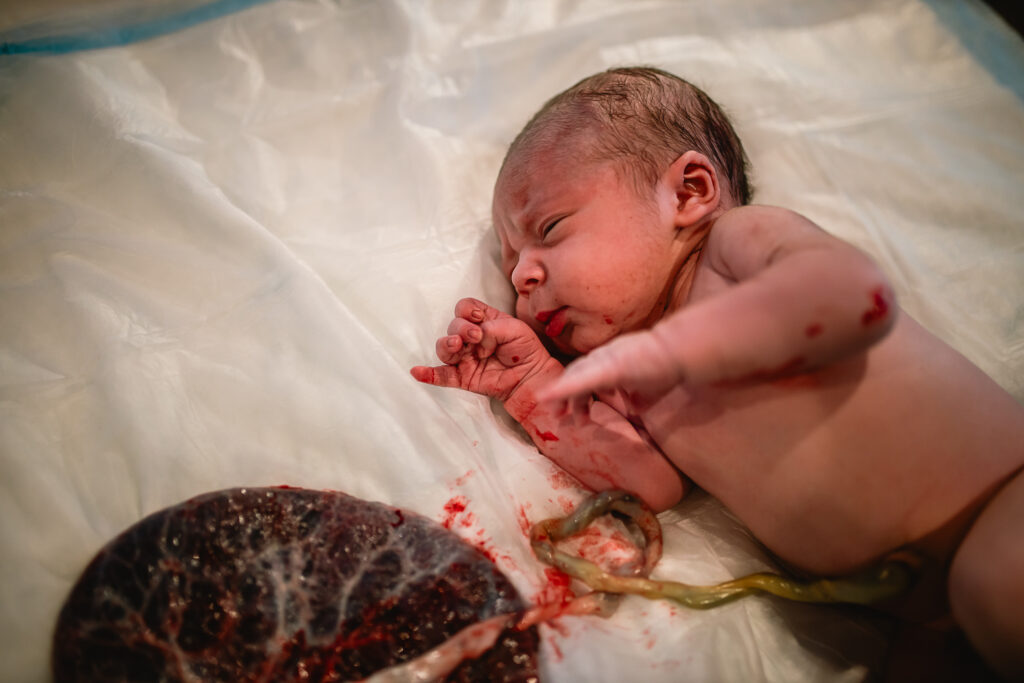 Newborn resting peacefully next to the placenta with the umbilical cord still connected after birth