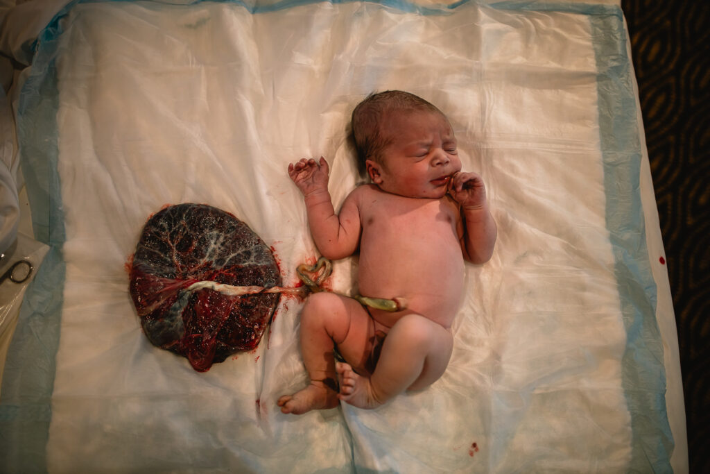 Newborn baby lying next to the placenta, documenting delayed cord clamping after birth