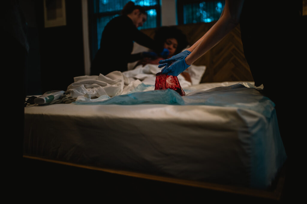Midwife holding the placenta wrapped in a blue pad while standing beside the birth bed after delivery