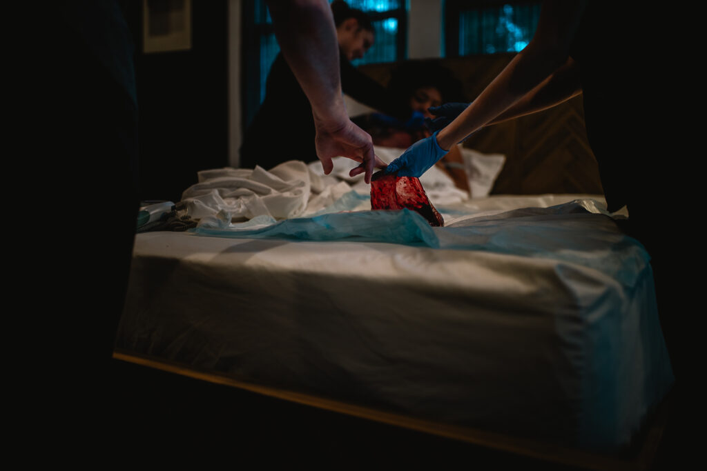Placenta being examined and wrapped by the birth team on the bed after delivery