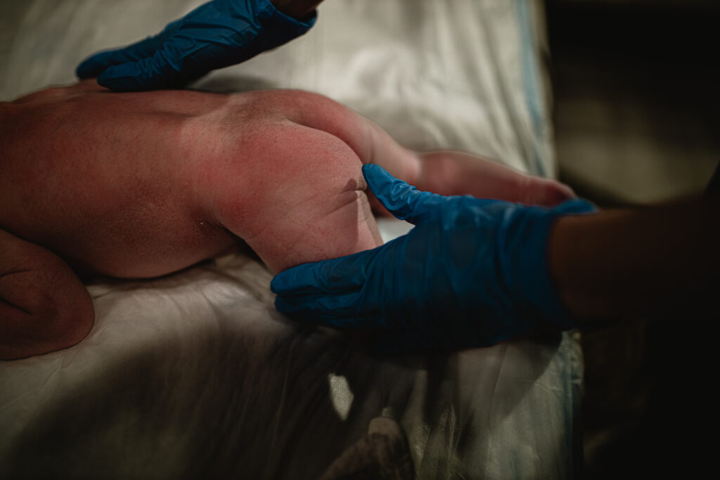 Close-up of midwife examining newborn’s back and skin
