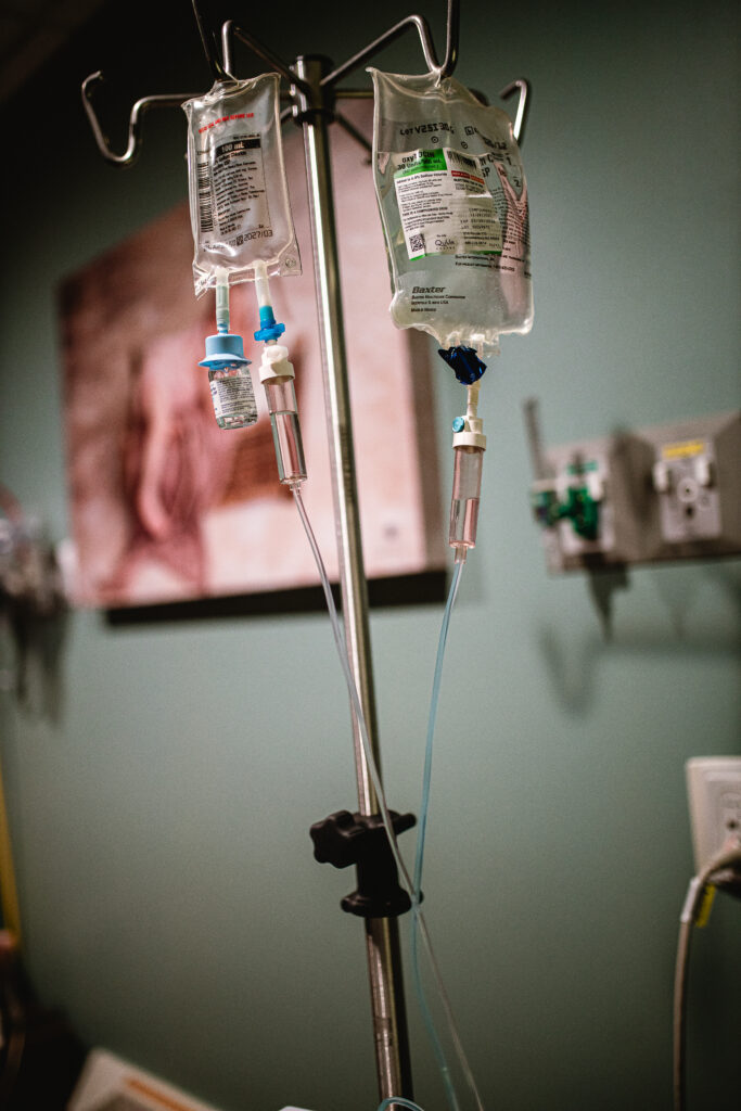 Hospital room prepared for labor induction in Fort Worth, showing monitors and a calm birth environment.
